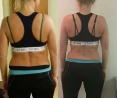 массаж корректирующий фигуру LPG - 4