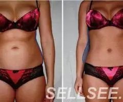 Аппаратная коррекция фигуры быстро, без диет и тренировок - 2