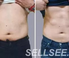 Аппаратная коррекция фигуры быстро, без диет и тренировок - 3
