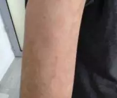 Кайыпов Айболот Кайырбекович врач дерматовенеролог - 2