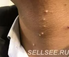 Кайыпов Айболот Кайырбекович врач дерматовенеролог - 3