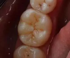 Все виды стоматологических услуг - 2