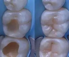 Все виды стоматологических услуг - 4