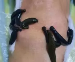 Врач стоматолог, ИКМ массажист, хиджамист, гирудотерапевт - 4