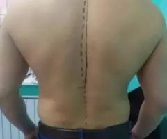 Костоправ Кыргызстан Бишкек. Мануальная терапия массаж - 4