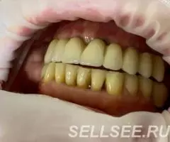 Имплантация зубов. Наш адрес г. Бишкек, ул. Байтик баатыра ... - 2