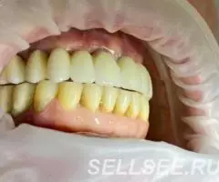 Имплантация зубов. Наш адрес г. Бишкек, ул. Байтик баатыра ... - 3