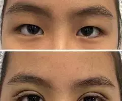 Все виды пластической хирургии! - 2