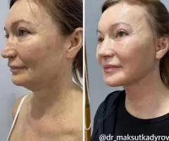 Все виды пластической хирургии! - 3