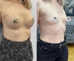 Все виды пластической хирургии! - 4