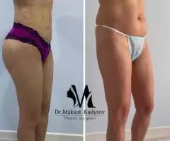 Все виды пластической хирургии! - 6
