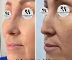 Все виды пластической хирургии! - 7