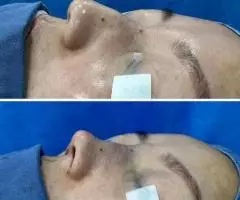 Все виды пластической хирургии! - 8