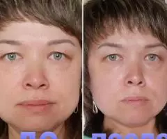 Комплексный уход кожи против пигментации для идеального тона лица Novage+ Bright Intense от Орифлэйм - 5