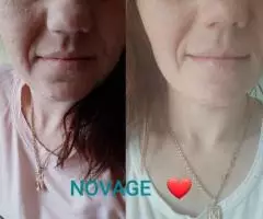 Комплексный уход кожи против пигментации для идеального тона лица Novage+ Bright Intense от Орифлэйм - 7